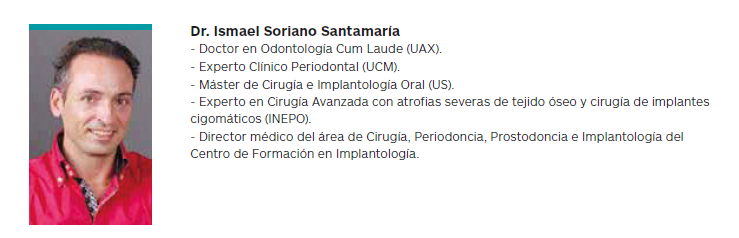 REHABILITACIÓN TOTAL SUPERIOR DE CARGA INMEDIATA CON QUISTECTOMÍA