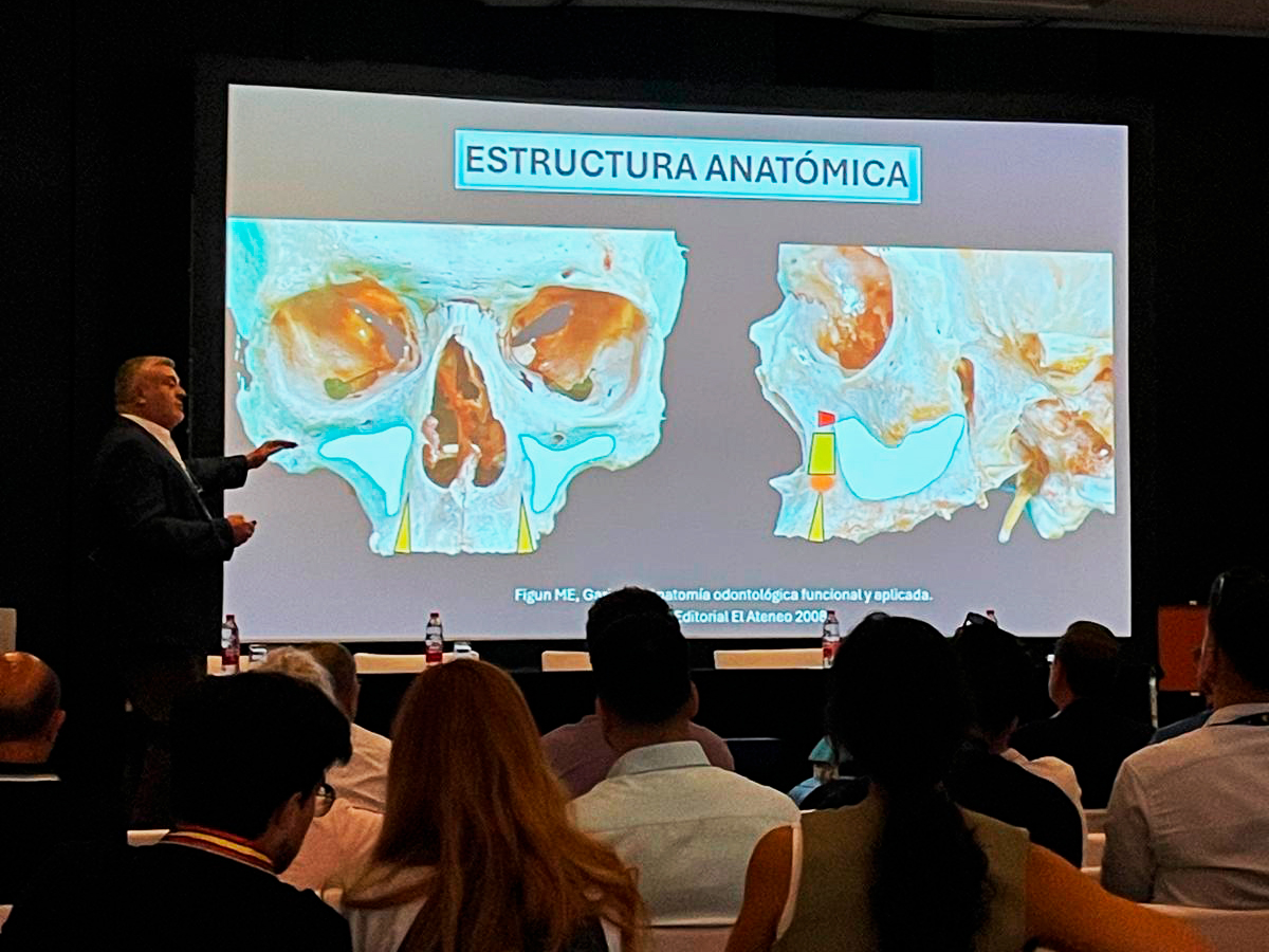 XXXVI Congreso Nacional y XXIX Congreso Internacional de la Sociedad Española de Implantes XXXVI Congreso Nacional y XXIX Congreso Internacional de la Sociedad Española de Implantes